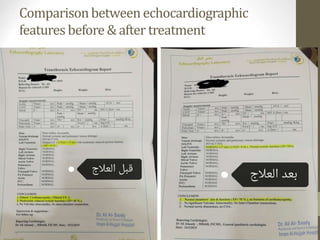 Comparisonbetweenechocardiographic
features before& after treatment
 