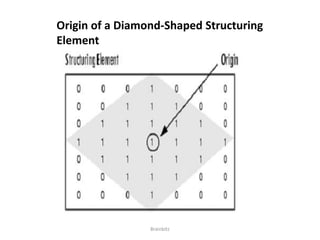 Origin of a Diamond-Shaped Structuring 
Element 
Brainbitz 
 