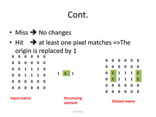 Cont. 
• Miss  No changes 
• Hit  at least one pixel matches =>The 
origin is replaced by 1 
0 0 0 0 0 0 
0 0 0 0 0 0 
0 0 1 1 1 0 
0 0 1 1 1 0 
0 0 0 0 0 0 
0 0 0 0 0 0 
0 0 0 0 0 0 
0 0 0 0 0 0 
0 1 1 1 1 1 
0 1 1 1 1 1 
0 0 0 0 0 0 
0 0 0 0 0 0 
1 1 1 
Input matrix Structuring 
element Dilated matrix 
Brainbitz 
 