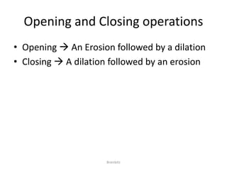 Opening and Closing operations 
• Opening  An Erosion followed by a dilation 
• Closing  A dilation followed by an erosion 
Brainbitz 
 