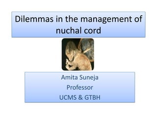 Dilemmas in the management of nuchal cord,[object Object],Amita Suneja,[object Object],Professor,[object Object],UCMS & GTBH,[object Object]