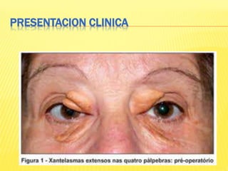 PRESENTACION CLINICA
 