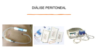 DIÁLISE PERITONEAL
 