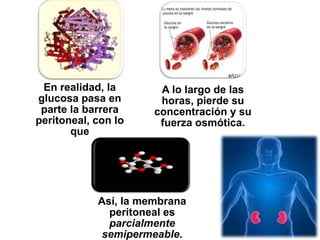En realidad, la       A lo largo de las
glucosa pasa en        horas, pierde su
 parte la barrera     concentración y su
peritoneal, con lo     fuerza osmótica.
       que




            Así, la membrana
              peritoneal es
              parcialmente
            semipermeable.
 