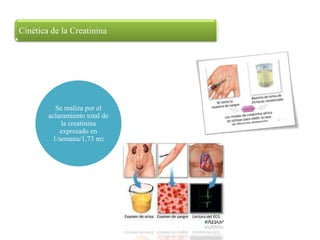Cinética de la Creatinina




          Se realiza por el
        aclaramiento total de
            la creatinina
            expresado en
         1/semana/1,73 m2
 