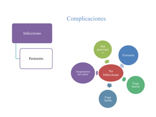 Complicaciones

Infecciosas


                                     Mal
                                   posicione
                                       s
                                                     Extrusión
   Peritonitis


                    Atrapamiento           No
                     del catéter       Infecciosas

                                                             Fuga
                                                            Inicial


                                        Fuga
                                        Tardía
 