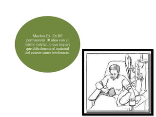 Muchos Px. En DP
 permanecen 10 años con el
mismo cateter, lo que sugiere
que dificilmente el material
del cateter cause intoleracia.
 