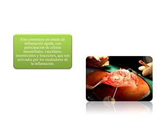 Esta constituye un estado de
       inflamación aguda, con
Inflamación Peritoneal
       participación de células
      mesoteliales, vasculares,
 intersticiales y leucocitos, que son
  activados por los mediadores de
            la inflamación.
 