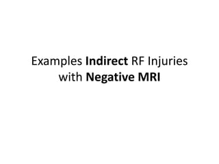 Examples Indirect RF Injuries
with Negative MRI
 