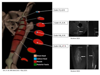 Kerr, R. M. MRI Web Clinic—May 2014.
Code I-PP-G-R.
Code I-P1-G-R.
Code I-M2-G-R.
Code I-M2-GR-R.
Brukner 2015
Brukner 2015
 