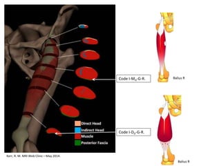 Kerr, R. M. MRI Web Clinic—May 2014.
Code I-MD-G-R.
Code I-DD-G-R.
Balius R
Balius R
 
