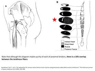 Hasselman, Carl T., et al. "An explanation for various rectus femoris strain injuries using previously undescribed muscle architecture." The American journal
of sports medicine 23.4 (1995): 493-499.
Note that although this diagram implies purity of each of proximal tendons, there is a 10% overlap
between the tendinous fibers.
 