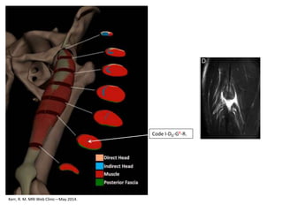 Kerr, R. M. MRI Web Clinic—May 2014.
Code I-DD-GR-R.
 