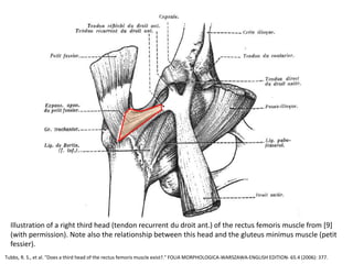 Tubbs, R. S., et al. "Does a third head of the rectus femoris muscle exist?." FOLIA MORPHOLOGICA-WARSZAWA-ENGLISH EDITION- 65.4 (2006): 377.
Illustration of a right third head (tendon recurrent du droit ant.) of the rectus femoris muscle from [9]
(with permission). Note also the relationship between this head and the gluteus minimus muscle (petit
fessier).
 