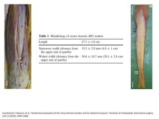 Iriuchishima, Takanori, et al. "Anatomical evaluation of the rectus femoris tendon and its related structures." Archives of orthopaedic and trauma surgery
132.11 (2012): 1665-1668.
 