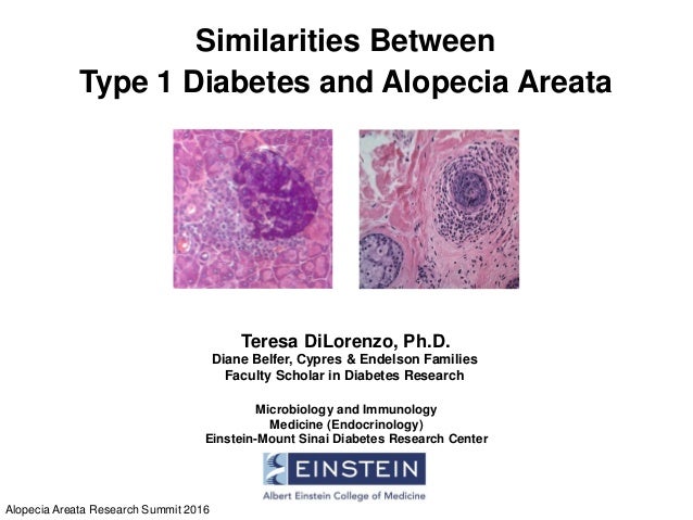 Similarities Between Type 1 Diabetes And Alopecia Areata