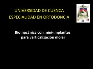 UNIVERSIDAD DE CUENCA
ESPECIALIDAD EN ORTODONCIA


  Biomecánica con mini-implantes
     para verticalización molar
 