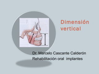 Dimensión
               ver tical



Dr. Marcelo Cascante Calderón
Rehabilitación oral implantes
 