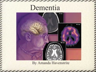 Dementia
By Amanda Havenstrite
 