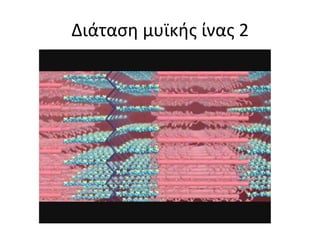 Διάταση μυϊκής ίνας 2