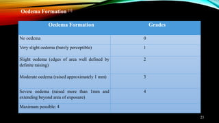 Oedema Formation Grades
No oedema 0
Very slight oedema (barely perceptible) 1
Slight oedema (edges of area well defined by
definite raising)
2
Moderate oedema (raised approximately 1 mm) 3
Severe oedema (raised more than 1mm and
extending beyond area of exposure)
4
Maximum possible: 4
Oedema Formation [1]
23
 