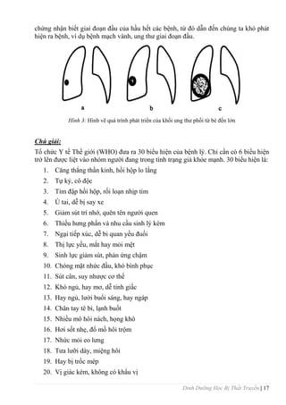Dinh Dưỡng Học Bị Thất Truyền | 17
chứng nhận biết giai đoạn đầu của hầu hết các bệnh, từ đó dẫn đến chúng ta khó phát
hiện ra bệnh, ví dụ bệnh mạch vành, ung thƣ giai đoạn đầu.
Hình 3: Hình vẽ quá trình phát triển của khối ung thƣ phổi từ bé đến lớn
Chú giải:
Tổ chức Y tế Thế giới (WHO) đƣa ra 30 biểu hiện của bệnh lý. Chỉ cần có 6 biểu hiện
trở lên đƣợc liệt vào nhóm ngƣời đang trong tình trạng giả khỏe mạnh. 30 biểu hiện là:
1. Căng thẳng thần kinh, hồi hộp lo lắng
2. Tự kỷ, cô độc
3. Tim đập hồi hộp, rối loạn nhịp tim
4. Ù tai, dễ bị say xe
5. Giảm sút trí nhớ, quên tên ngƣời quen
6. Thiếu hƣng phấn và nhu cầu sinh lý kém
7. Ngại tiếp xúc, dễ bi quan yếu đuối
8. Thị lực yếu, mắt hay mỏi mệt
9. Sinh lực giảm sút, phản ứng chậm
10. Chóng mặt nhức đầu, khó bình phục
11. Sút cân, suy nhƣợc cơ thể
12. Khó ngủ, hay mơ, dễ tỉnh giấc
13. Hay ngủ, lƣời buổi sáng, hay ngáp
14. Chân tay tê bì, lạnh buốt
15. Nhiều mô hôi nách, họng khô
16. Hơi sốt nhẹ, đổ mồ hôi trộm
17. Nhức mỏi eo lƣng
18. Tƣa lƣỡi dày, miệng hôi
19. Hay bị trốc mép
20. Vị giác kém, không có khẩu vị
 