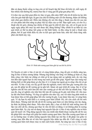 Dinh Dưỡng Học Bị Thất Truyền | 32
đặn sử dụng thuốc uống ra ông còn có kế hoạch tập thể thao rất kiên trì, mỗi ngày đi
bao nhiêu mét đƣờng bộ, matxa bao lâu ở vùng gan để giúp gan phục hồi.
Cứ nhƣ vậy sau thời gian đỉều trị, bảo vệ gan, đến năm 2007 chú tôi đi kiểm tra lại, khi
siêu âm gan thật bất ngờ, lá gan của chú tôi không một vết tổn thƣơng, thậm chí không
một chút gan nhiễm mỡ. Điều này không chỉ nói lên rằng y thuật của chú tôi cao mà
có còn phản ánh khả năng tự phục hồi kỳ diệu của cơ thể. Bạn nghĩ xem, cứ cho là y
thuật chú tôi giỏi, nhƣng bao nhiêu tế bào gan bị chết đi nhƣ vậy, chỉ có lá gan tự nó
ngày ngày phục hồi mọc lại mới đƣợc thế, đúng không? Đây chính là sự thần kỳ của
quá trình cơ thể tự phục hồi giúp cơ thể lành bệnh, và đây cũng là một y thuật siêu
phàm, bởi lẽ quá trình điều trị cho ra kết quả quá hoàn hảo, nhƣ thể chƣa từng mắc
phải căn bệnh này vậy.
Hình 10: Hình ảnh xƣơng quai hàm gắn lại sau khi bị cắt bỏ
Tứ Xuyên có một vị bác sĩ mà tôi vô cùng khâm phục, ông rất già và nhiều sáng tạo,
ông là bác sĩ khoa xƣơng khớp. Nhƣng ông không vừa lòng với những gì hiện có, ông
thấy công việc hiện tại chẳng có chút gì là tạo dựng một sự nghiệp mới, do vậy ông
tìm đến một ngƣời bạn là chủ trang trại nuôi gà để nhờ giúp. Ngƣời bạn chủ trang trại
không biết có thể giúp đƣợc gì cho bác sĩ vì ở trang trại ngoài gà ra cũng vẫn chỉ có gà
mà thôi. Vị bác sĩ này xin lấy gà để làm thí nghiệm, trƣớc tiên làm gãy xƣơng đùi của
gà, sau đó ghép lại để xƣơng gà tự gắn kết. Quan sát quá trình đó xong, bác sĩ sẽ lại
nghiên cứu để tìm cách làm thế nào cho xƣơng gà có thể nối liền lại nhanh hơn. Tiếp
sau đó, ông sẽ nghiên cứu tiếp làm thế nào để xƣơng gà bị gãy một khúc rồi vẫn mọc
lại dài nhƣ bình thƣờng. Và ông cứ nghiên cứu nhƣ vậy, sau vài năm ông phát minh ra
loại dƣợc liệu có thể giúp phục hồi cho xƣơng bị gãy. Loại dƣợc liệu này vô cùng hiệu
quả. Ví dụ bạn bị một khối u ở xƣơng quai hàm (Hình 10), chỉ còn cách cắt bỏ mới
khỏi đƣợc. Nhƣng một khi đã cắt đi thì xƣơng quai hàm coi nhƣ không còn tác dụng,
ăn thức ăn không nhai đƣợc. Nếu nhƣ trƣớc đây y học sẽ thiết kế một miếng inox để
lắp vào chỗ cắt bỏ, nhƣng quả thực là vẫn rất khó cử động vì nó không phải là xƣơng
quai hàm thật. Ấy vậy mà sử dụng loại nguyên liệu do vị bác sĩ này nghiên cứu ra hiệu
quả rất tuyệt vời. Ông dùng nguyên liệu của mình nắn thành đoạn xƣơng đã cắt bỏ sau
đó ghép khít vào đoạn nối giữa hai mảnh xƣơng quai hàm. Hai đầu xƣơng quai hàm sẽ
có xu hƣớng mọc về phía miếng nguyên liệu nhân tạo mà bác sĩ đã ghép vào giữa và
xƣơng mọc đến đâu nó sẽ tiêu hóa nguyên liệu nhân tạo đến đó. Cuối cùng cả một
xƣơng quai hàm mới đƣợc mọc ra một cách hoàn chỉnh. Sự sáng tạo của vị bác sĩ này
 