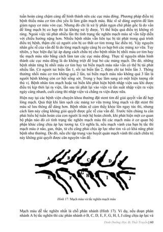 Dinh Dưỡng Học Bị Thất Truyền | 60
tuần hoàn càng chậm càng dễ hình thành nên các cục máu đông. Phƣơng pháp điều trị
bệnh thiếu máu cơ tim chủ yếu là làm giãn mạch máu. Bác sĩ sẽ dùng aspirin để làm
giảm nguy cơ máu vón cục. Nhƣng đó chỉ là xử lý phần ngọn chứ phần gốc là do vấn
đề lòng mạch bị co hẹp thì lại không xử lý đƣợc. Vì thế hiệu quả điều trị không rõ
ràng. Ngoài việc tái phát nhiều lần thì tình trạng tắc nghẽn mạch máu sẽ vẫn tiếp diễn
với chiều hƣớng nặng hơn. Nhiều bệnh nhân vẫn liên tục bị tái phát trong quá trình
điều trị bệnh, thậm chí có ngƣời còn bị co thắt cơ tim trong lúc điều trị. Vậy nguyên
nhân gốc rễ của vấn đề là do lòng mạch ngày càng bị co hẹp bởi các mảng xơ vữa. Tuy
nhiên, y học hiện đại lại áp dụng cách chữa trị cho bệnh nhân bị nhồi máu cơ tim hay
tắc mạch máu não bằng cách làm tan các cục máu đông. Thực tế nguyên nhân hình
thành các cục máu đông là do không triệt để loại bỏ các mảng mạch. Do đó, những
bệnh nhân từng bị nhồi máu cơ tim hay tai biến mạch máu não vẫn có thể bị tái phát
nhiều lần. Có ngƣời tai biến lần 1, rồi tai biến lần 2, thậm chí tai biến lần 3. Thông
thƣờng nhồi máu cơ tim không quá 2 lần, tai biến mạch máu não không quá 3 lần là
ngƣời bệnh không còn cơ hội sống sót. Trong y học lâm sang có một hiện tƣợng rất
thú vị. Bệnh nhân tim mạch hoặc tai biến khi phát hiện bệnh nhập viện sau khi đƣợc
điều trị kịp thời lại ra viện, lần sau tái phát lại vào viện và tần suất nhập viện ra viện
ngày càng nhanh, cuối cùng thì nhập viện và chẳng ra viện đƣợc nữa.
Hiện nay tại các bệnh viện chuyên khoa thƣờng đặt stent tim để giải quyết vấn đề hẹp
lòng mạch. Quả thật khi làm sạch các mảng xơ vữa trong lòng mạch và đặt stent thì
máu sẽ lƣu thông dễ dàng hơn. Bệnh nhân sẽ cảm thấy khỏe lên ngay tức thì, nhƣng
cách làm này cũng không giải quyết đƣợc gốc rễ của vấn đề. Trƣớc tiên chúng ta cần
phải hiểu hệ tuần hoàn của con ngƣời là một hệ hoàn chỉnh, khi phát hiện một cơ quan
bộ phận nào đó có tình trạng tắc nghẽn mạch máu thì các mạch máu ở cơ quan bộ
phận khác cũng chịu áp lực tƣơng tự. Có nghĩa là, nếu mạch vành của bạn bị tắc thì
mạch máu ở não, gan, thận, tứ chi cũng phải chịu áp lực nhƣ tim và có khả năng phát
bệnh nhƣ thƣờng. Do đó, nếu chỉ tập trung vảo huyết quản mạch vành thì cách chữa trị
này không giải quyết đƣợc căn nguyên vấn đề.
Hình 17: Mạch máu và tắc nghẽn mạch máu
Mạch máu dễ tắc nghẽn nhất là chỗ phân nhánh (Hình 17). Ví dụ, nếu đoạn phân
nhánh A bị tắc nghẽn thì các phân nhánh ở B, C, D, E, F, G, H, I, J cũng chịu áp lực và
 