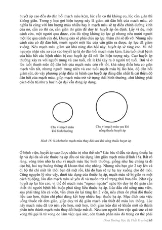 Dinh Dưỡng Học Bị Thất Truyền | 63
huyết áp cao đều do đàn hồi mạch máu kém, lúc cần co thì không co, lúc cần giãn thì
không giãn. Trong y học gọi hiện tƣợng này là giảm sút đàn hồi của mạch máu, có
nghĩa là cùng với lƣu lƣợng máu nhiều hay ít mạch máu sẽ tự điều chỉnh đƣờng kính
của nó, cần co thì co, cần giãn thì giãn để duy trì huyết áp ổn định. Lấy ví dụ, một
cánh cửa, một ngƣời qua đƣợc, cửa đủ rộng không áp lực gì nhƣng nếu mƣời ngƣời
một lúc qua cánh cửa đó, khung cửa sẽ phải chịu áp lực, thậm chí sẽ đổ vỡ. Nhƣng nếu
cánh cửa có độ đàn hồi, mƣời ngƣời một lúc cửa vẫn giãn ra đƣợc, áp lực đã giảm
xuống. Nếu mạch máu giảm sút khả năng đàn hồi này, huyết áp sẽ tăng cao. Vì thế
nguyên nhân sâu xa của cao huyết áp là do đàn hồi mạch máu kém. Lứa tuổi phát bệnh
của hầu hết các bệnh nhân bị cao huyết áp đã nói lên hiện tƣợng này. Cao huyết áp
thƣờng xảy ra với ngƣời trung và cao tuổi, rất ít khi xảy ra ở ngƣời trẻ tuổi. Bởi vì ở
lứa tuổi thanh niên độ đàn hồi của mạch máu còn rất tốt, khả năng điều hòa co giãn
mạch vẫn tốt, nhƣng ngƣời trung niên và cao tuổi mạch máu bị lão hóa, độ đàn hồi
giảm sút, do vậy phƣơng pháp điều trị bệnh cao huyết áp đúng đắn nhất là cải thiện độ
đàn hồi của mạch máu, giúp mạch máu trở về trạng thái bình thƣờng, chứ không phải
cách điều trị nhƣ y học hiện đại vẫn đang áp dụng.
Hình 18: Kích thƣớc mạch máu thay đổi sau khi uống thuốc huyet áp
Ở bệnh viện, huyết áp cao đƣợc chữa trị nhƣ thế nào? Các bác sĩ đều sử dụng thuốc hạ
áp và đại đa số các thuốc hạ áp đều có tác dụng làm giãn mạch máu (Hình 18). Rất rõ
ràng, vòng tròn nhỏ là chu vi mạch máu lúc bình thƣờng, giống nhƣ lúc chúng ta đi
dạo bộ, hai tay buông thõng đi khoan thai nhẹ nhàng. Nhƣng nếu bạn giơ 2 tay lên và
đi bộ thì chỉ một lát thôi bạn đã mệt rồi, khi đó bạn sẽ tự hạ tay xuống cho đỡ mỏi.
Cũng nguyên lý nhƣ vậy, dƣới tác dụng của thuốc hạ áp, mạch máu sẽ bị giãn ra một
cách bị động, lâu dần mạch máu sẽ yếu đi và muốn trở về trạng thái ban đầu. Nhƣ vậy
huyết áp lại lên cao, vì thế để mạch máu “ngoan ngoãn” nghe lời duy trì độ giãn cần
thiết thì ngƣời bệnh bắt buộc phải tăng liều thuốc hạ áp. Lúc đầu chỉ uống nửa viên,
sau phải tăng lên cả viên, vẫn chƣa ổn lại tăng lên 2 viên, nếu chƣa ổn phải đổi thuốc
liều cao hơn, thậm chí phải dùng kết hợp nhiều loại thuốc hạ áp. Mục đích của việc
uống thuốc rất đơn giản, giúp duy trì độ giãn mạch cần thiết để máu lƣu thông. Lúc
này mạch máu đã trở nên yếu hơn, mệt hơn, thời gian kéo dài sẽ khiến một số thành
phần trên thành mạch máu thay đổi hoặc mất đi. Nếu con ngƣời làm việc quá sức và tử
vong thì gọi là tử vong do làm việc quá sức, còn thành phần nào đó trong cơ thể phải
Chu vi mạch máu
khi bình thƣờng
Chu vi mạch máu sau khi
uống thuốc huyết áp
 