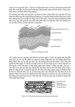 Dinh Dưỡng Học Bị Thất Truyền | 82
viêm cổ tử cung mãn tính... Ngoài các bệnh mãn tính ra thì các tổn thƣơng mãn tính
khác đều xuất phát từ thói quen sinh hoạt không lành mạnh nhƣ hút thuốc, uống rƣợu,
thức khuya, ăn thực phẩm công nghiệp...
Tôi thƣờng bào chữa cho ung thƣ, tôi chính là luật sƣ bào chữa cho ung thƣ. Tôi cho
rằng bản thân ung thƣ cũng không dễ dàng gì vì ung thƣ không muốn sống trên cơ thể
bạn, nhƣng bạn lại cứ muốn nó sống trên cơ thể mình. Chúng ta cũng thử phƣơng pháp
nửa y học nửa dân gian để xem tiến trình phát triển của ung thƣ, nhƣ vậy chúng ta sẽ
có cái nhìn rõ hơn và hiểu sâu hơn về ung thƣ.
Hình 24: Cấu tạo da cơ bản
Từ ý nghĩa nào đó, ung thƣ xuất hiện từ sự thích nghi. Cơ thể con ngƣời tiến hóa đến
ngày nay, tại sao các bộ phận con ngƣời có hình dạng nhƣ vậy chứ không phải hình
dạng khác? Tại sao lại cấu tạo nhƣ vậy chứ không phải cấu tạo khác? Tất cả đều bắt
nguồn từ thích nghi. Ví dụ da của bạn sở dĩ có cấu tạo nhƣ vậy là vì da là lớp bảo vệ
bên ngoài cơ thể nên phải có khả năng ngăn chặn, chống va đập, kéo dãn, vặn vẹo...
cho nên da có cấu tạo nhƣ vậy (Hình 24). Da đƣợc cấu tạo bởi rất nhiều tầng tế bào,
giữa các tầng tế bào có một lực gắn kết rất chắc, lớp sừng ngoài cùng là những tế bào
da khô và chết đi, nhƣ vậy da có khả năng chịu mài mòn rất tốt, lớp dƣới đó lại là
những tế bào liên tục tái tạo thành tế bào lớp sừng già và chết đi, do vậy có thể duy trì
khả năng chịu mài mòn của da. Theo bạn da có cấu tạo nhƣ vậy có phải là mang tính
thích nghi hay không?
Hình 25A: Cấu tạo lớp niêm mạc của khí quản và phế quản
Lớp sừng (tế bào tróc vẩy)
Lớp tế bào hạt
Lớp tế bào gai
Lớp tế bào đáy
Lớp niêm mạc
Lông mao
Tế bào hình tròn
Tế bào hình trụ
 