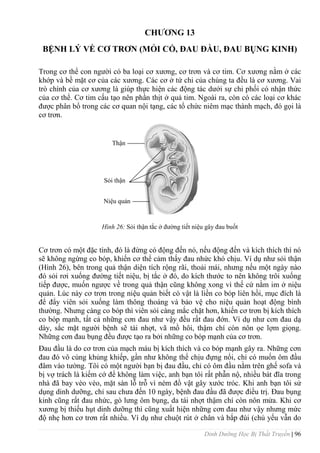 Dinh Dưỡng Học Bị Thất Truyền | 96
CHƢƠNG 13
BỆNH LÝ VỀ CƠ TRƠN (MỎI CỔ, ĐAU ĐẦU, ĐAU BỤNG KINH)
Trong cơ thể con ngƣời có ba loại cơ xƣơng, cơ trơn và cơ tim. Cơ xƣơng nằm ở các
khớp và bề mặt cơ của các xƣơng. Các cơ ở tứ chi của chúng ta đều là cơ xƣơng. Vai
trò chính của cơ xƣơng là giúp thực hiện các động tác dƣới sự chi phối có nhận thức
của cơ thể. Cơ tim cấu tạo nên phần thịt ở quả tim. Ngoài ra, còn có các loại cơ khác
đƣợc phân bổ trong các cơ quan nội tạng, các tổ chức niêm mạc thành mạch, đó gọi là
cơ trơn.
Hình 26: Sỏi thận tắc ở đƣờng tiết niệu gây đau buốt
Cơ trơn có một đặc tính, đó là đừng có động đến nó, nếu động đến và kích thích thì nó
sẽ không ngừng co bóp, khiến cơ thể cảm thấy đau nhức khó chịu. Ví dụ nhƣ sỏi thận
(Hình 26), bên trong quả thận diện tích rộng rãi, thoải mái, nhƣng nếu một ngày nào
đó sỏi rơi xuống đƣờng tiết niệu, bị tắc ở đó, do kích thƣớc to nên không trôi xuống
tiếp đƣợc, muốn ngƣợc về trong quả thận cũng không xong vì thế cứ nằm im ở niệu
quản. Lúc này cơ trơn trong niệu quản biết có vật là liền co bóp liên hồi, mục đích là
để đẩy viên sỏi xuống làm thông thoáng và bảo vệ cho niệu quản hoạt động bình
thƣờng. Nhƣng càng co bóp thì viên sỏi càng mắc chặt hơn, khiến cơ trơn bị kích thích
co bóp mạnh, tất cả những cơn đau nhƣ vậy đều rất đau đớn. Ví dụ nhƣ cơn đau dạ
dày, sắc mặt ngƣời bệnh sẽ tái nhợt, vã mồ hôi, thậm chí còn nôn ọe lợm giọng.
Những cơn đau bụng đều đƣợc tạo ra bởi những co bóp mạnh của cơ trơn.
Đau đầu là do cơ trơn của mạch máu bị kích thích và co bóp mạnh gây ra. Những cơn
đau đó vô cùng khủng khiếp, gần nhƣ không thể chịu đựng nổi, chỉ có muốn ôm đầu
đâm vào tƣờng. Tôi có một ngƣời bạn bị đau đầu, chỉ có ôm đầu nằm trên ghế sofa và
bị vợ trách là kiếm cớ để không làm việc, anh bạn tôi rất phẫn nộ, nhiều bát đĩa trong
nhà đã bay vèo vèo, mặt sàn lỗ trỗ vì ném đồ vật gây xƣớc tróc. Khi anh bạn tôi sử
dụng dinh dƣỡng, chỉ sau chƣa đến 10 ngày, bệnh đau đầu đã đƣợc điều trị. Đau bụng
kinh cũng rất đau nhức, gò lƣng ôm bụng, da tái nhợt thậm chí còn nôn mửa. Khi cơ
xƣơng bị thiếu hụt dinh dƣỡng thì cũng xuất hiện những cơn đau nhƣ vậy nhƣng mức
độ nhẹ hơn cơ trơn rất nhiều. Ví dụ nhƣ chuột rút ở chân và bắp đùi (chủ yếu vẫn do
Thận
Sỏi thận
Niệu quản
 