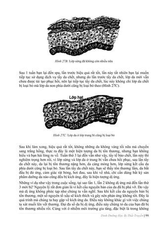 Dinh Dưỡng Học Bị Thất Truyền | 99
Hình 27B: Lớp sừng đã không còn nhiều nữa
Sau 1 tuần bạn lại đến spa, lần trƣớc hiệu quả rất tốt, lần này tất nhiên bạn lại muốn
tiếp tục sử dụng dịch vụ tầy da chết, nhƣng do lần trƣớc tẩy da chết, lớp da mới vẫn
chƣa đƣợc tái tạo phục hồi, nên lại tiếp tục tẩy da chết, lúc này không chỉ lớp da chết
bị loại bỏ mà lớp da non phía dƣới cũng bị loại bỏ theo (Hình 27C).
Hình 27C: Lớp da ở lớp trung bì cũng bị loại bỏ
Sau khi làm xong, hiệu quả rất tốt, không những da không vàng tối nữa mà chuyển
sang trắng hồng, thực ra đây là một hiện tƣợng da bị tổn thƣơng, nhƣng bạn không
hiểu và bạn hài lòng ra về. Tuần thứ 3 lại đến vẫn nhƣ vậy, tẩy tế bào chết, lần này thì
nghiêm trọng hơn rồi, vì lớp sừng và lớp da ở trung bì vẫn chƣa hồi phục, sau lần tẩy
da chết này, da lại bị tổn thƣơng nặng hơn, da càng mỏng hơn, lớp sừng kết cấu da
phía dƣới cũng bị loại bỏ. Sau lần tẩy da chết này, bạn sẽ thấy tổn thƣơng lắm, da bắt
đầu bị đỏ ửng, cảm giác rát bỏng, hơi đau, sau khi về nhà, chỉ cần dùng bất kỳ sản
phẩm dƣỡng da nào cũng đều bị kích ứng, đây là hiện tƣợng dị ứng.
Những ví dụ nhƣ vậy trong cuộc sống, tại sao lần 1, lần 2 không dị ứng mà đến lần thứ
3 mới bị? Nguyên lý rất đơn giản là vì kết cấu nguyên bản của da đã bị phá vỡ. Do vậy
mà dị ứng không phức tạp nhƣ chúng ta vẫn nghĩ. Sau khi kết cấu da nguyên bản bị
tổn thƣơng, một số nguyên tố xấu sẽ kích thích và gây nên phản ứng không tốt. Đây là
quá trình mà chúng ta hay gặp về kích ứng da. Điều này không khác gì với việc chúng
ta xát muối lên vết thƣơng. Đại đa số da bị dị ứng, điều này chứng tỏ da của bạn đã bị
tổn thƣơng nhiều rồi. Cùng với ô nhiễm môi trƣờng gia tăng, đặc biệt là trong không
 