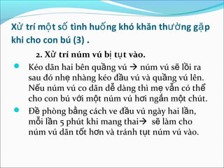 Xử trí mộ t số tình huố ng khó khăn thườ ng gặ p
khi cho con bú (3) .
    2. Xử trí núm vú bị tụ t vào.
 Kéo dãn hai bên quầng vú  núm vú sẽ lồi ra
  sau đó nhẹ nhàng kéo đầu vú và quầng vú lên.
  Nếu núm vú co dãn dễ dàng thì mẹ vẫn có thể
  cho con bú với một núm vú hơi ngắn một chút.
 Đề phòng bằng cách ve đầu vú ngày hai lần,
  mỗi lần 5 phút khi mang thai sẽ làm cho
  núm vú dãn tốt hơn và tránh tụt núm vú vào.
 