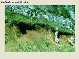 Arcilla de descalcificación 