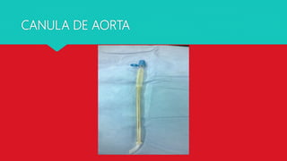 CANULA DE AORTA
 