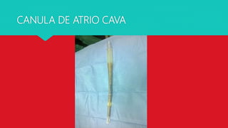 CANULA DE ATRIO CAVA
 