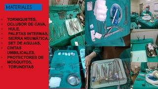 • TORNIQUETES,
• OCLUSOR DE CAVA,
• HULE,
• PALETAS INTERNAS,
• SIERRA NEUMÁTICA,
• SET DE AGUJAS,
• CINTAS
UMBILICALES,
• PROTECTORES DE
MOSQUITOS,
• TORUNDITAS
MATERIALES
 