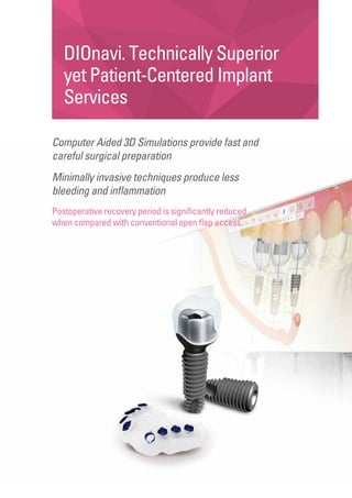 Computer Aided 3D Simulations provide fast and
careful surgical preparation
Minimally invasive techniques produce less
bleeding and inflammation
Postoperative recovery period is significantly reduced
when compared with conventional open flap access.
DIOnavi. Technically Superior
yet Patient-Centered Implant
Services
 