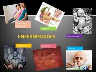 Disrupcion
hormonal
             Organos


                        Mutaciones


Cerebrales   Cloracné
                        Cáncer
 
