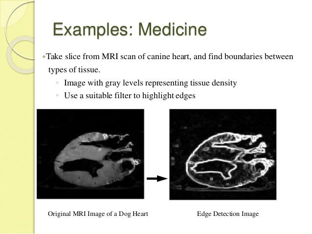 Thesis in medical imaging and graphics