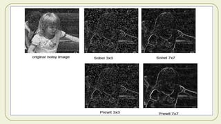 Digital Image Processing Edges Detection Methods | PDF