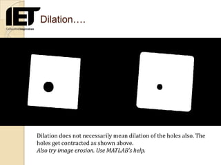 Dilation….




Dilation does not necessarily mean dilation of the holes also. The
holes get contracted as shown above.
Also try image erosion. Use MATLAB’s help.
 