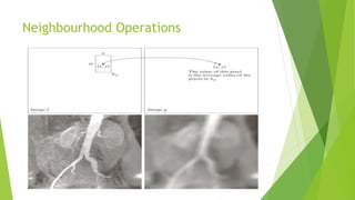 Neighbourhood Operations
 