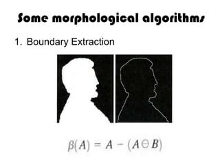 Some morphological algorithms
1. Boundary Extraction
 