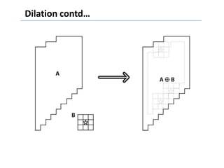 Dilation contd…
 