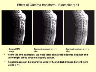 Effect of Gamma transform - Examples γ <1

Original MRI
image

Gamma transform, c =1, γ
=0.6

Gamma transform, c =1, γ
=0.4

•

From the two examples, we note that: dark areas become brighter and
very bright areas become slightly darker.

•

Faint images can be improved with γ >1, and dark images benefit from
using γ <1.

 