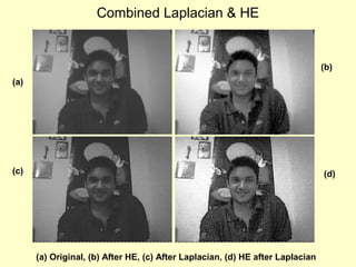 Combined Laplacian & HE

(b)
(a)

(c)

(d)

(a) Original, (b) After HE, (c) After Laplacian, (d) HE after Laplacian

 
