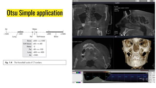 Otsu Simple application
 