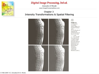 Digital image processing chapter 3rd full | PPT