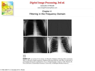 Digital Image Processing, 3rd ed.
www.ImageProcessingPlace.com
© 1992–2008 R. C. Gonzalez & R. E. Woods
Gonzalez & Woods
Chapter 4
Filtering in the Frequency Domain
 